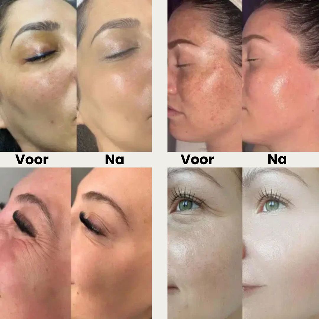 Masker met LED-lichttherapie